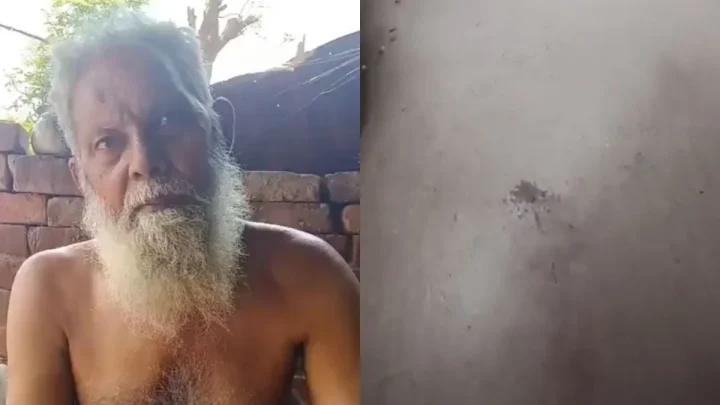 Elderly Muslim Hawker Brutally Beaten And Robbed In Uttar Pradesh After Being Told To Go To Pakistan