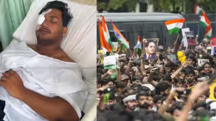 Indian Police Blind Unarmed Delhi University Student Sahil Lochab With Pellet Guns In New Delhi Protests
